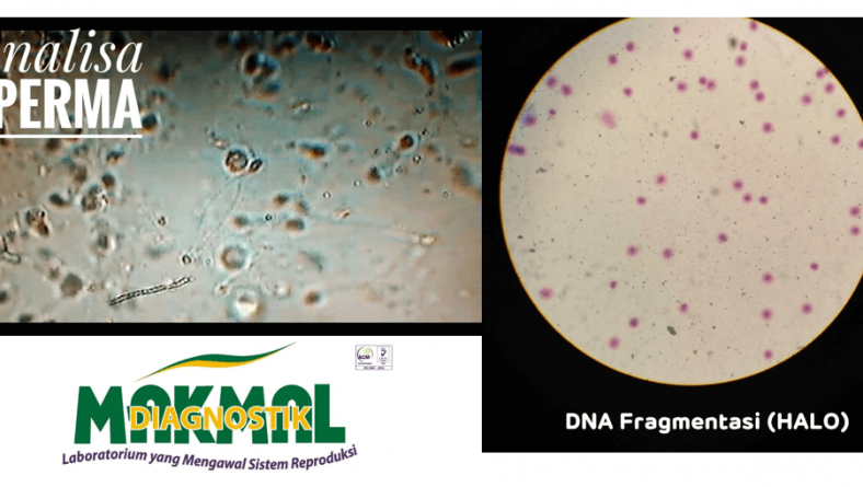 ANALISA SPERMA
